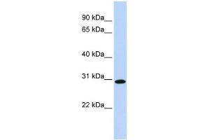 SMNDC1 antibody used at 1 ug/ml to detect target protein. (SMNDC1 抗体  (Middle Region))