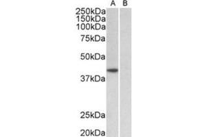 AP31930PU-N TBP antibody staining of HeLa nuclear (A) and cytosolic (B) lysates at 1 µg/ml (35µg protein in RIPA buffer). (TBP 抗体  (Internal Region))