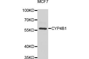 Western blot analysis of extracts of MCF-7 cells, using CYP4B1 antibody. (CYP4B1 抗体)