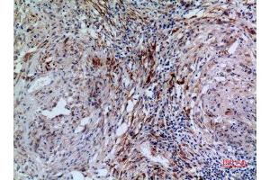 Immunohistochemistry (IHC) analysis of paraffin-embedded Human Lung, antibody was diluted at 1:100. (17beta-HSD4 (N-Term) 抗体)