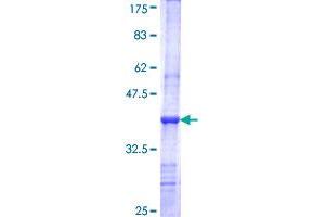 Image no. 1 for Leucine-Rich Repeat LGI Family, Member 3 (LGI3) (AA 449-548) protein (GST tag) (ABIN1309352) (LGI3 Protein (AA 449-548) (GST tag))