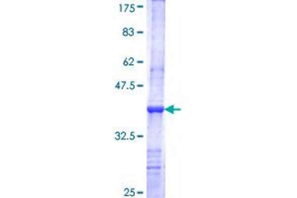 LGI3 Protein (AA 449-548) (GST tag)