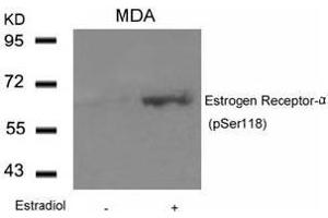 Image no. 3 for anti-Estrogen Receptor 1 (ESR1) (pSer118) antibody (ABIN196742) (Estrogen Receptor alpha 抗体  (pSer118))