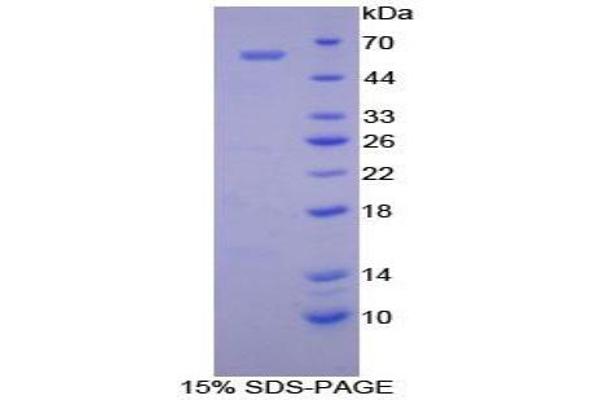 Cadherin 4 Protein (CDH4)