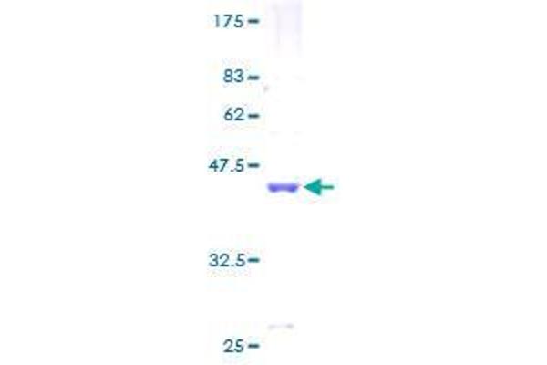 Pre-mRNA Branch Site Protein p14 (SF3B14) (AA 1-125) protein (GST tag)