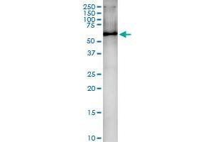 Immunoprecipitation of HDAC1 transfected lysate using anti-HDAC1 MaxPab rabbit polyclonal antibody and Protein A Magnetic Bead , and immunoblotted with HDAC1 MaxPab mouse polyclonal antibody (B01) . (HDAC1 抗体  (AA 1-482))