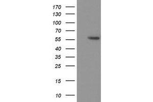 HEK293T cells were transfected with the pCMV6-ENTRY control (Left lane) or pCMV6-ENTRY TP53 (Right lane) cDNA for 48 hrs and lysed. (p53 抗体)