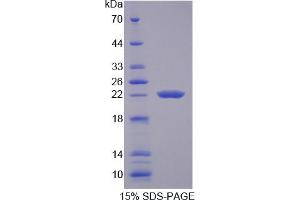 Image no. 1 for Transient Receptor Potential Cation Channel, Subfamily M, Member 7 (TRPM7) (AA 19-179) protein (His tag) (ABIN4990471) (TRPM7 Protein (AA 19-179) (His tag))