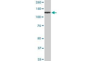 CAND1 monoclonal antibody (M03), clone 2D7. (CAND1 抗体  (AA 1-100))