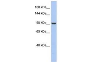 Image no. 1 for anti-PMS2 Postmeiotic Segregation Increased 2 (S. Cerevisiae) (PMS2) (AA 611-660) antibody (ABIN6743977) (PMS2 抗体  (AA 611-660))