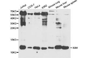 Western blot analysis of extracts of various cell lines, using B2M antibody (ABIN5970743) at 1/1000 dilution. (beta-2 Microglobulin 抗体)