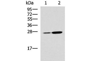 Western blot analysis of Mouse kidney tissue and Mouse liver tissue lysates using NQO2 Polyclonal Antibody at dilution of 1:1000 (NQO2 抗体)