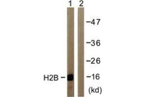 Western blot analysis of extracts from COS7 cells, treated with TSA 400nM 24h, using Histone H2B (Ab-12) Antibody. (Histone H2B 抗体  (AA 10-59))