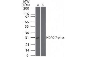 Image no. 1 for anti-Histone Deacetylase 7 (HDAC7) (pSer318) antibody (ABIN225622) (HDAC7 抗体  (pSer318))