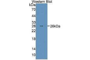 Detection of Recombinant ABCD2, Mouse using Polyclonal Antibody to ATP Binding Cassette Transporter D2 (ABCD2) (Abcd2 抗体  (AA 501-695))