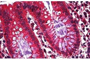 Human Colon, Epithelium: Formalin-Fixed, Paraffin-Embedded (FFPE) (Ghrelin 抗体  (AA 1-118))