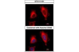 Image no. 4 for anti-Eukaryotic Translation Elongation Factor 1 delta (Guanine Nucleotide Exchange Protein) (EEF1D) (AA 310-647) antibody (ABIN1497948) (EEF1D 抗体  (AA 310-647))