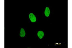 Immunofluorescence (IF) image for anti-X-Ray Repair Complementing Defective Repair in Chinese Hamster Cells 6 (XRCC6) (AA 1-609) antibody (ABIN560973)