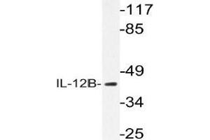 Western blot (WB) analysis of IL-12B antibody in extracts from K562 cells. (IL12B 抗体)