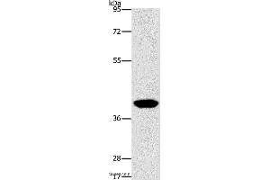 Western blot analysis of Human lymphoma tissue, using AGXT2L2 Polyclonal Antibody at dilution of 1:500 (AGXT2L2 抗体)
