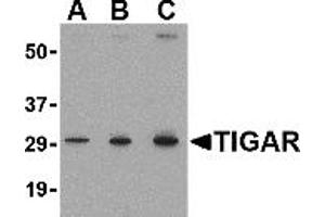Western Blotting (WB) image for anti-TP53 induced glycolysis regulatory phosphatase (TIGAR) (Middle Region 2) antibody (ABIN1031205) (TIGAR 抗体  (Middle Region 2))