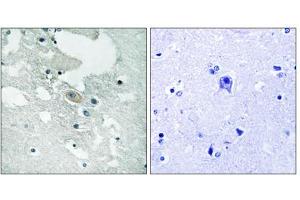 Immunohistochemistry analysis of paraffin-embedded human brain tissue using BLNK (Phospho-Tyr84) antibody. (B-Cell Linker 抗体  (pTyr84))