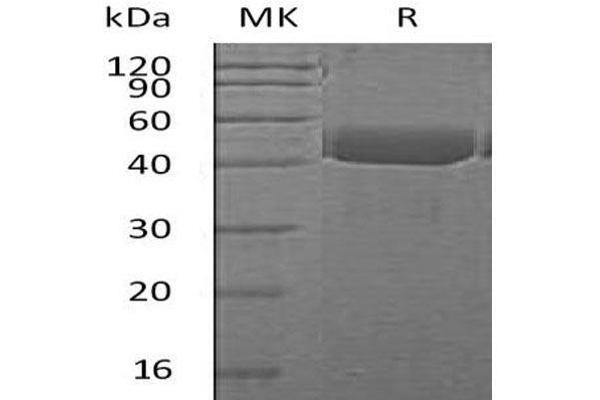 Cathepsin E Protein (CTSE) (AA 60-397) (His tag)