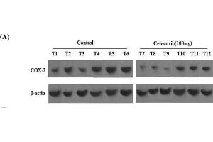 Western Blotting (WB) image for anti-Prostaglandin-Endoperoxide Synthase 2 (Prostaglandin G/H Synthase and Cyclooxygenase) (PTGS2) (AA 501-604) antibody (ABIN672471)