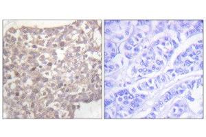 Immunohistochemistry (IHC) image for anti-Tubulin, gamma 1 (TUBG1) (C-Term) antibody (ABIN1848869) (TUBG1 抗体  (C-Term))