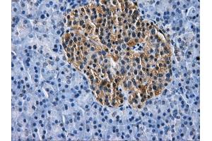 Immunohistochemical staining of paraffin-embedded pancreas tissue using anti-HDAC10mouse monoclonal antibody. (HDAC10 抗体)