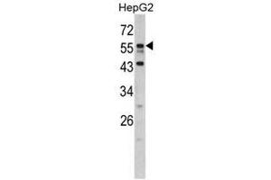 Image no. 1 for anti-Downstream Neighbor of SON (DONSON) (N-Term) antibody (ABIN452922) (DONSON 抗体  (N-Term))