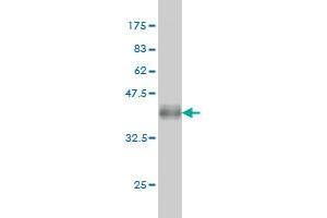 Western Blot detection against Immunogen (37. (FGFR2 抗体  (AA 621-723))