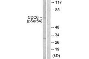 Western blot analysis of extracts from COS7 cells treated with EGF 200ng/ml 30', using CDC6 (Phospho-Ser54) Antibody. (CDC6 抗体  (pSer54))