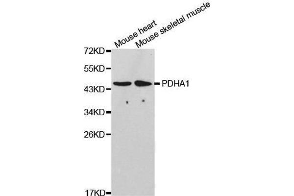 PDHA1 抗体  (AA 30-390)