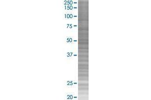 DCUN1D1 transfected lysate. (DCUN1D1 293T Cell Transient Overexpression Lysate(Denatured))