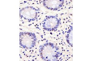 IHC-P analysis of human colon tissue. (PELP1 抗体)