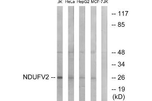 Western blot analysis of extracts from Jurkat cells, HeLa cells, HepG2 cells and MCF-7 cells, using NDUFV2 antibody. (NDUFV2 抗体  (Internal Region))