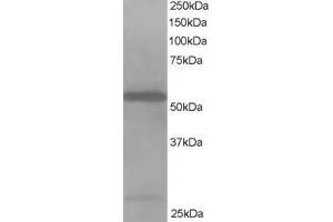 Western Blotting (WB) image for anti-Drebrin-Like (DBNL) antibody (ABIN5900113) (DBNL 抗体)