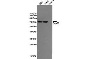 Western blot detection of Z70 in CEM and Jurkat cell lysates,negative in the Ramos cell lysates using Z70 mouse mAb (1:1000 diluted). (ZAP70 抗体)