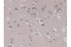 Detection of RALA in Human Cerebrum Tissue using Monoclonal Antibody to V-Ral Simian Leukemia Viral Oncogene Homolog A (RALA) (rala 抗体  (AA 1-206))