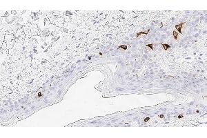 Immunohistochemistry (IHC) image for anti-CD207 Molecule, Langerin (CD207) antibody (ABIN7538905) (CD207 抗体)