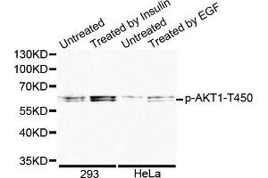 Western blot analysis of extracts of various cell lines, using Phospho-AKT1-T450 antibody. (AKT1 抗体  (pThr450))