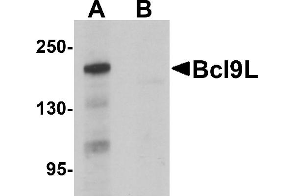 BCL9L 抗体  (N-Term)