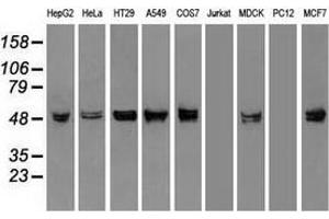 Western blot analysis of extracts (35 µg) from 9 different cell lines by using anti-KRT8 monoclonal antibody. (KRT8 抗体  (AA 91-381))