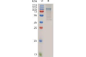 ADAM28 Protein (AA 21-668) (Fc Tag)