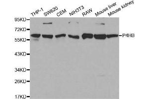 Western blot analysis of extracts of various cell lines, using P4HB antibody. (P4HB 抗体  (AA 329-508))