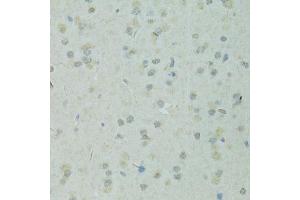 Immunohistochemistry of paraffin-embedded rat brain using TRIM28 antibody (ABIN1875205) at dilution of 1:100 (40x lens). (KAP1 抗体)