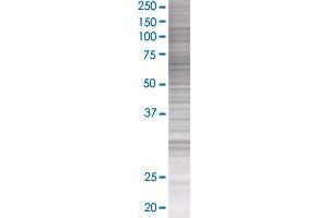 BEST1 transfected lysate. (VMD2 293T Cell Transient Overexpression Lysate(Denatured))