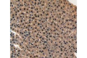 IHC-P analysis of liver tissue, with DAB staining. (Midkine 抗体  (AA 22-140))