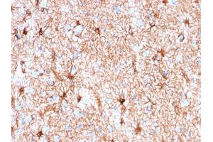 Immunohistochemistry (IHC) image for anti-Glial Fibrillary Acidic Protein (GFAP) antibody (ABIN6939508)